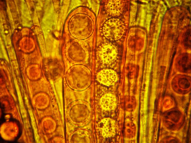 Altra Scutellinia da determinare